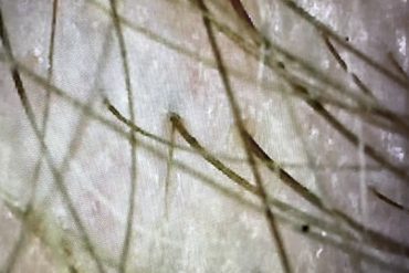 Qui d’autre que Pierre-Valentin Marchesseau, père de la Naturopathie en France, peut parler le mieux de la naturopathie ? :
